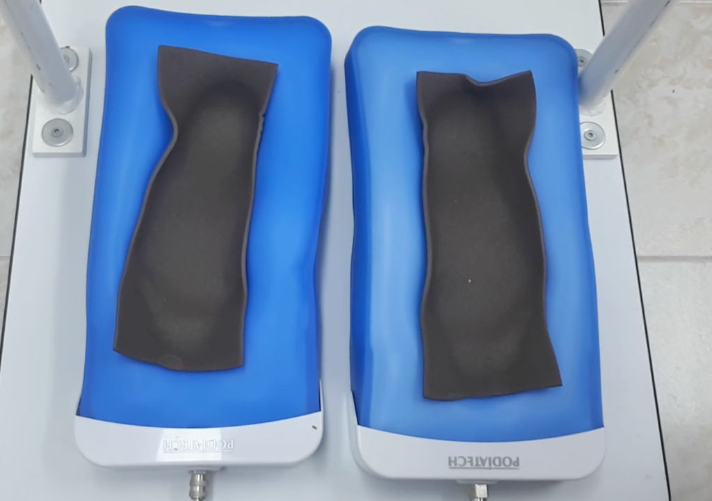 Stabilometrijski ulošci – Jedinstveno na tržištu!